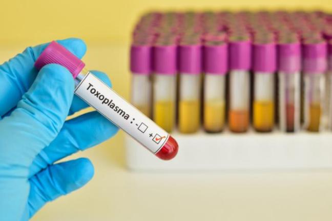 toxoplasmosi3