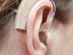 waardenburg-syndrome3