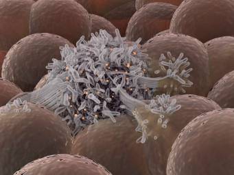 tumore al seno farmajet