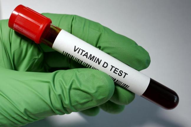 vitamina d test del sangue